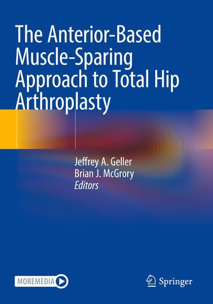 Produktbild: The Anterior-Based Muscle-Sparing Approach to Total Hip Arthroplasty