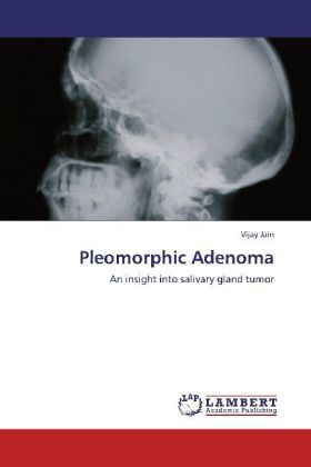 Produktbild: Jain, V: Pleomorphic Adenoma