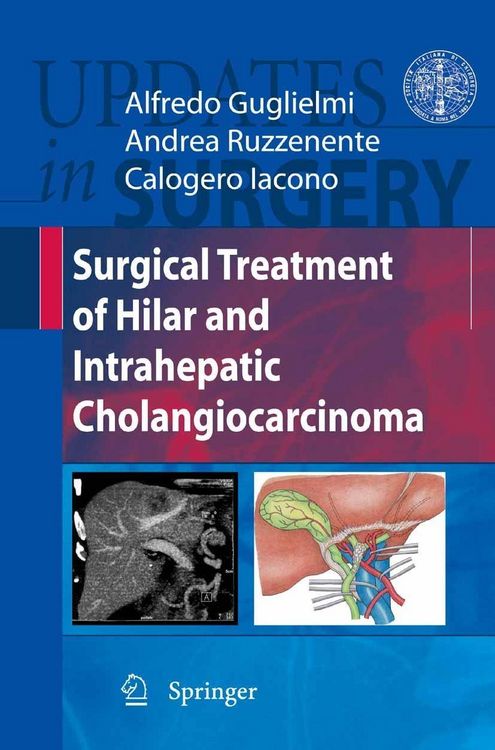 Produktbild: Surgical Treatment of Hilar and Intrahepatic Cholangiocarcinoma