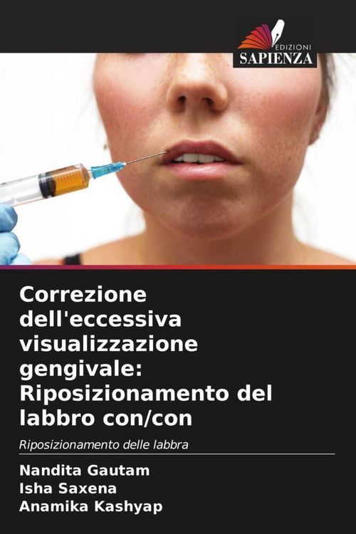 Produktbild: Correzione dell'eccessiva visualizzazione gengivale: Riposizionamento del labbro con/con