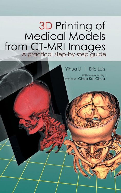 Produktbild: 3D Printing of Medical Models from CT-MRI Images