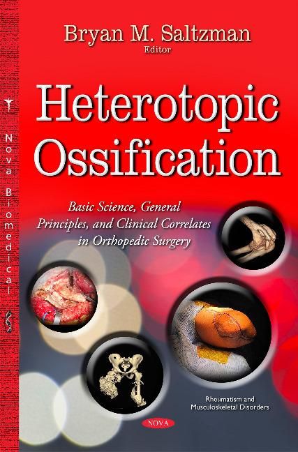 Produktbild: Heterotopic Ossification