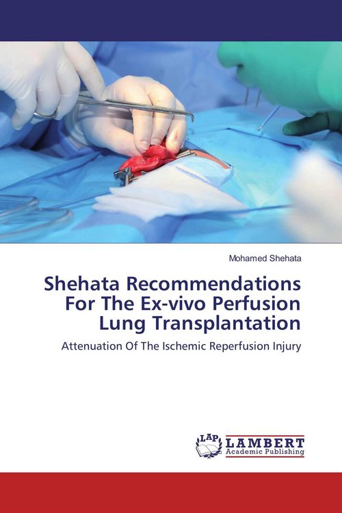 Produktbild: Shehata Recommendations For The Ex-vivo Perfusion Lung Transplantation