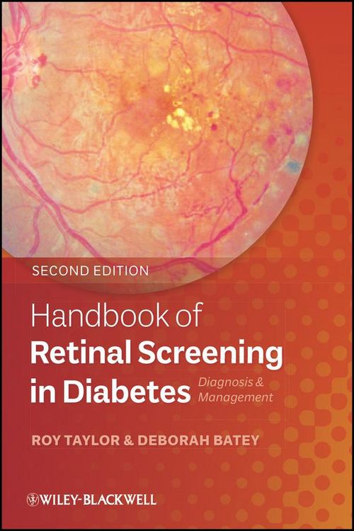 Produktbild: Handbook of Retinal Screening in Diabetes
