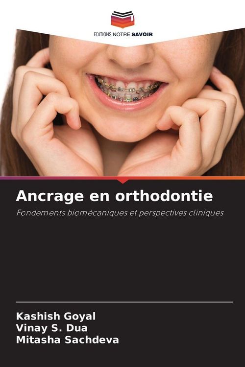 Produktbild: Ancrage en orthodontie