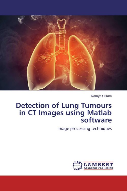 Produktbild: Detection of Lung Tumours in CT Images using Matlab software