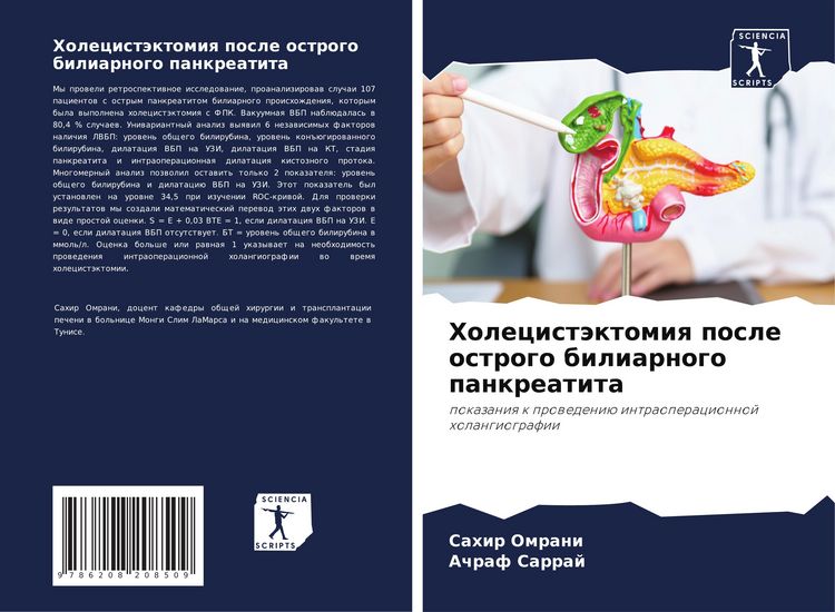 Produktbild: Holecist&auml;ktomiq posle ostrogo biliarnogo pankreatita