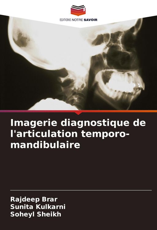 Produktbild: Imagerie diagnostique de l'articulation temporo-mandibulaire