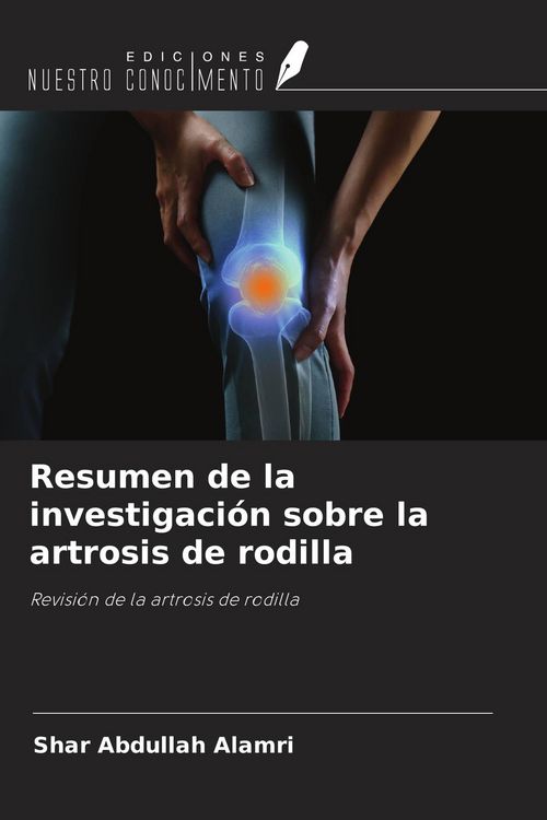 Produktbild: Resumen de la investigaci&oacute;n sobre la artrosis de rodilla