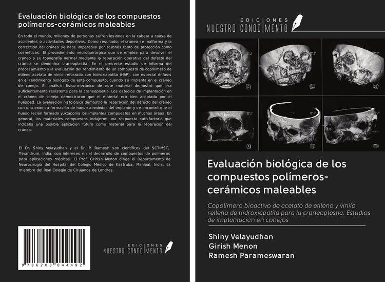 Produktbild: Evaluaci&oacute;n biol&oacute;gica de los compuestos pol&iacute;meros-cer&aacute;micos maleables