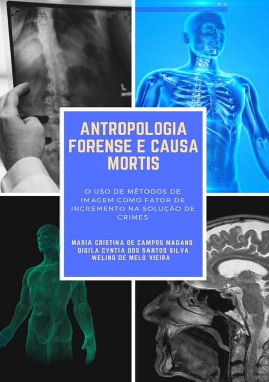 Produktbild: Antropologia Forense E Causa Mortis