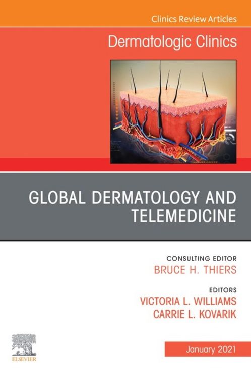 Produktbild: Global Dermatology and Telemedicine, An Issue of Dermatologic Clinics , E-Book