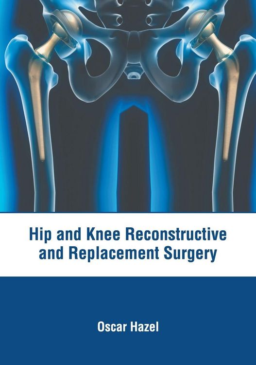 Produktbild: Hip and Knee Reconstructive and Replacement Surgery