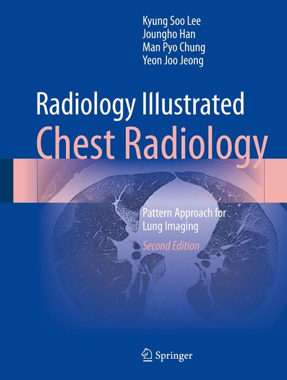 Produktbild: Radiology Illustrated: Chest Radiology