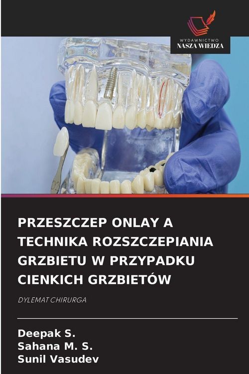 Produktbild: Przeszczep Onlay a Technika Rozszczepiania Grzbietu W Przypadku Cienkich Grzbiet&oacute;w