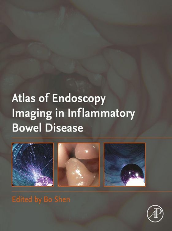 Produktbild: Atlas of Endoscopy Imaging in Inflammatory Bowel Disease