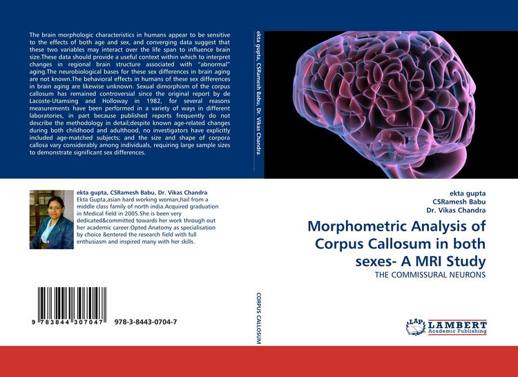 Produktbild: Morphometric Analysis of Corpus Callosum in both sexes- A MRI Study