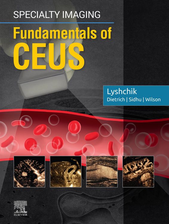 Produktbild: Specialty Imaging: Fundamentals of CEUS E-Book