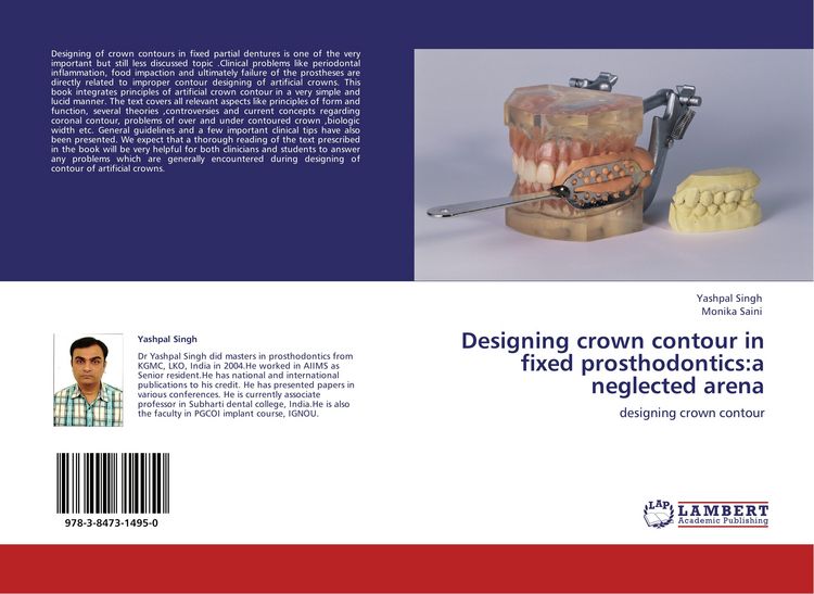Produktbild: Designing crown contour in fixed prosthodontics:a neglected arena