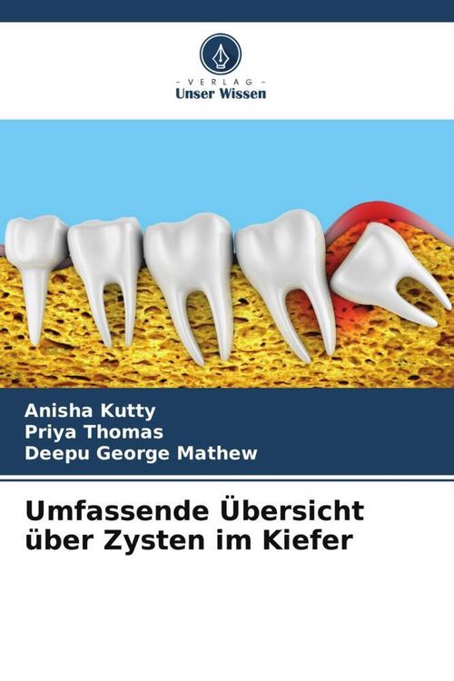 Produktbild: Umfassende &Uuml;bersicht &uuml;ber Zysten im Kiefer