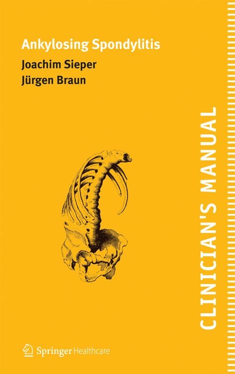 Produktbild: Clinician's Manual on Ankylosing Spondylitis