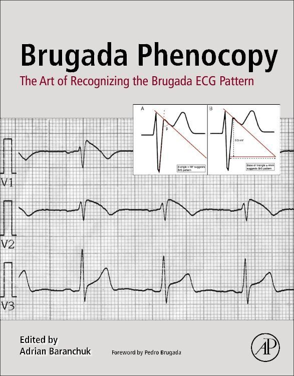 Produktbild: Brugada Phenocopy