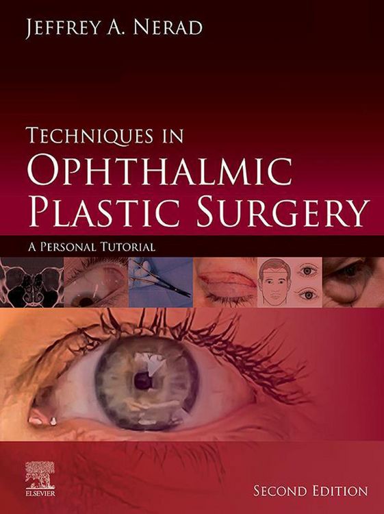 Produktbild: Techniques in Ophthalmic Plastic Surgery E-Book