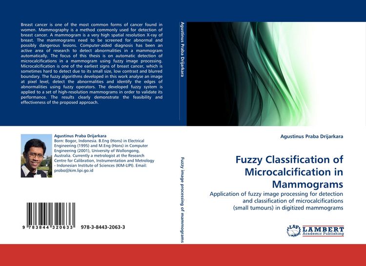 Produktbild: Fuzzy Classification of Microcalcification in Mammograms
