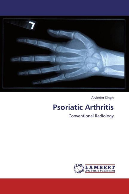 Produktbild: Singh, A: Psoriatic Arthritis