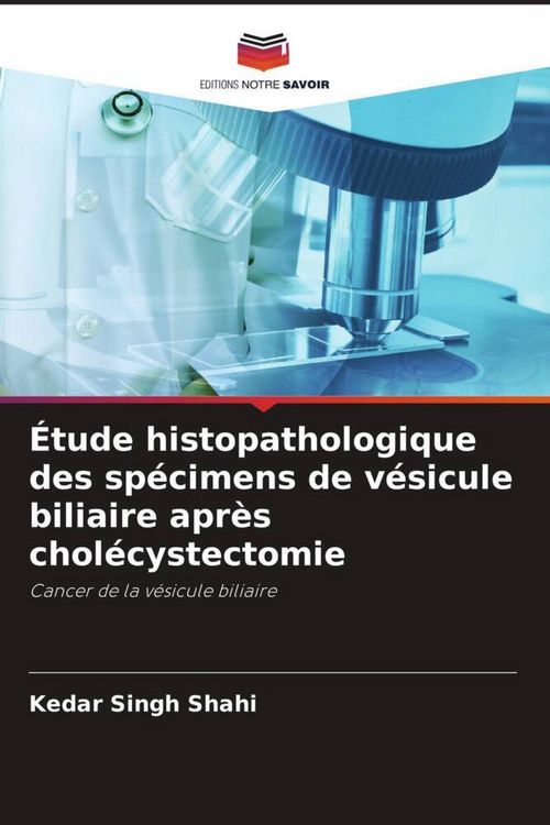 Produktbild: &Eacute;tude histopathologique des sp&eacute;cimens de v&eacute;sicule biliaire apr&egrave;s chol&eacute;cystectomie