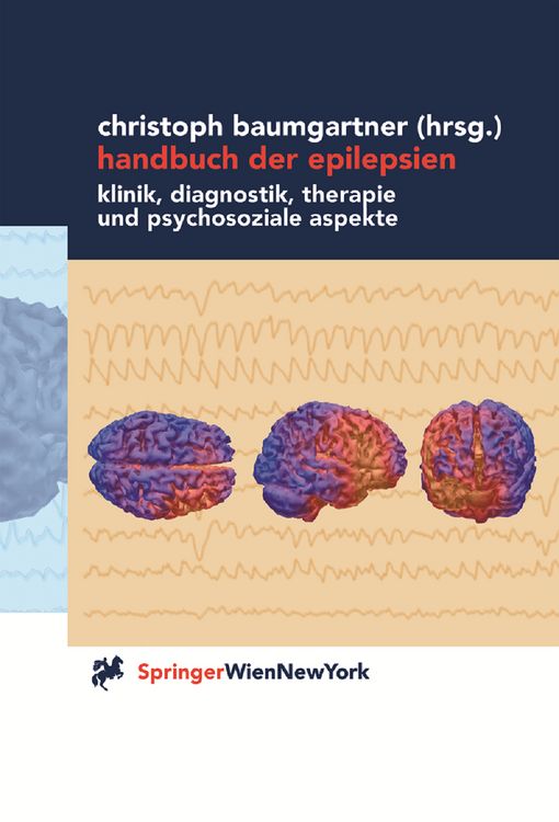 Produktbild: Handbuch der Epilepsien