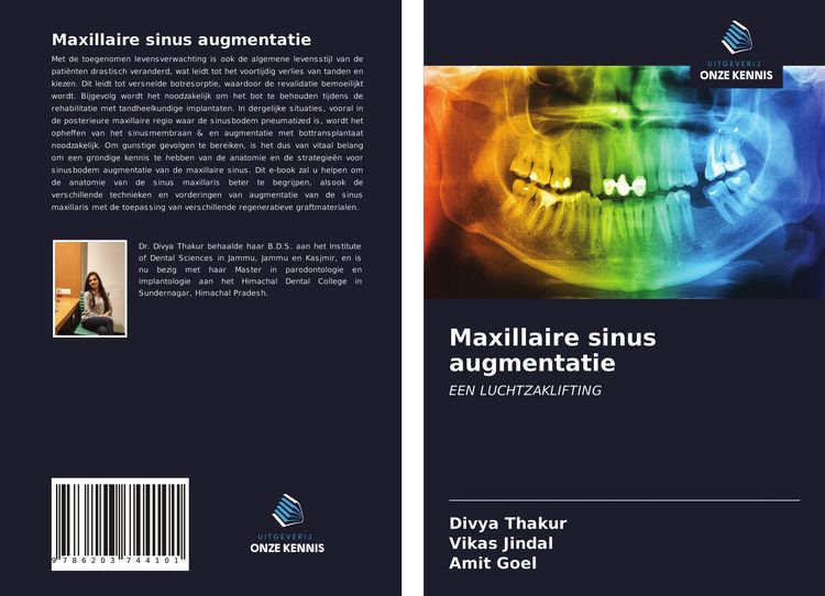 Produktbild: Maxillaire sinus augmentatie