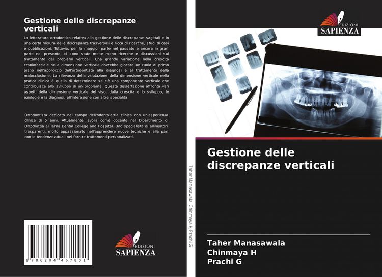 Produktbild: Gestione delle discrepanze verticali
