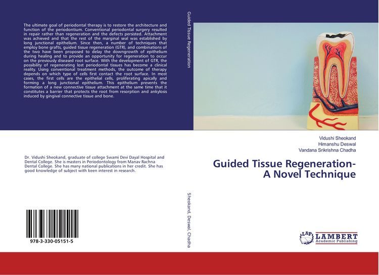 Produktbild: Guided Tissue Regeneration- A Novel Technique
