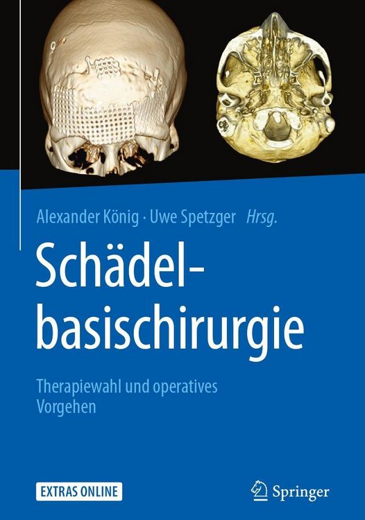 Produktbild: Sch&auml;delbasischirurgie