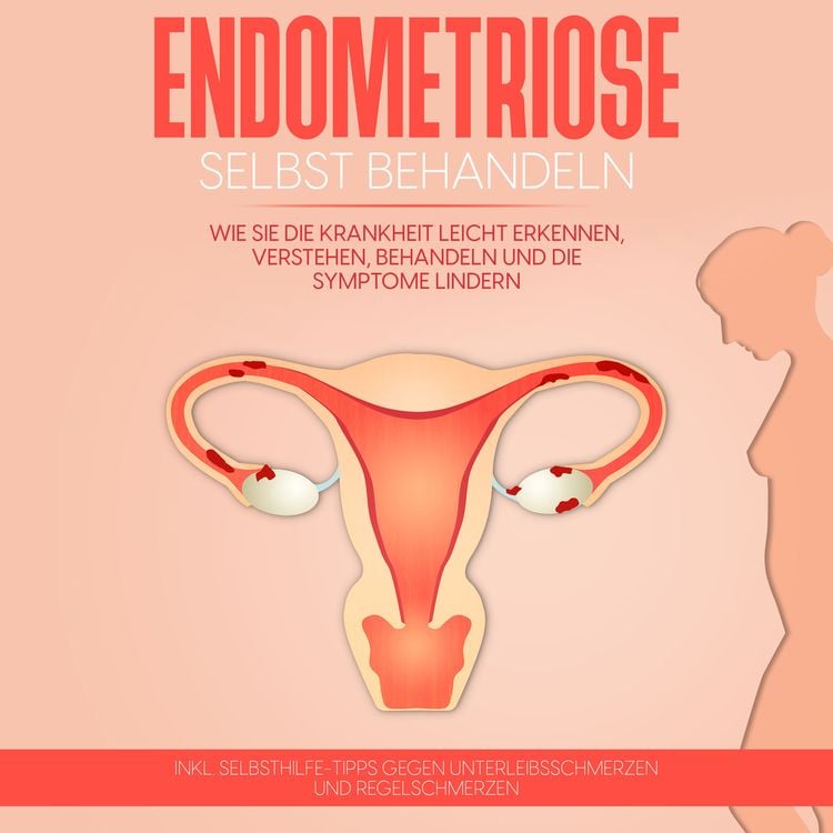 Produktbild: Endometriose selbst behandeln: Wie Sie die Krankheit leicht erkennen, verstehen, behandeln und die Symptome lindern - inkl. Selbsthilfe-Tipps gegen Unterleibsschmerzen und Regelschmerzen