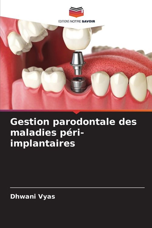 Produktbild: Gestion parodontale des maladies p&eacute;ri-implantaires