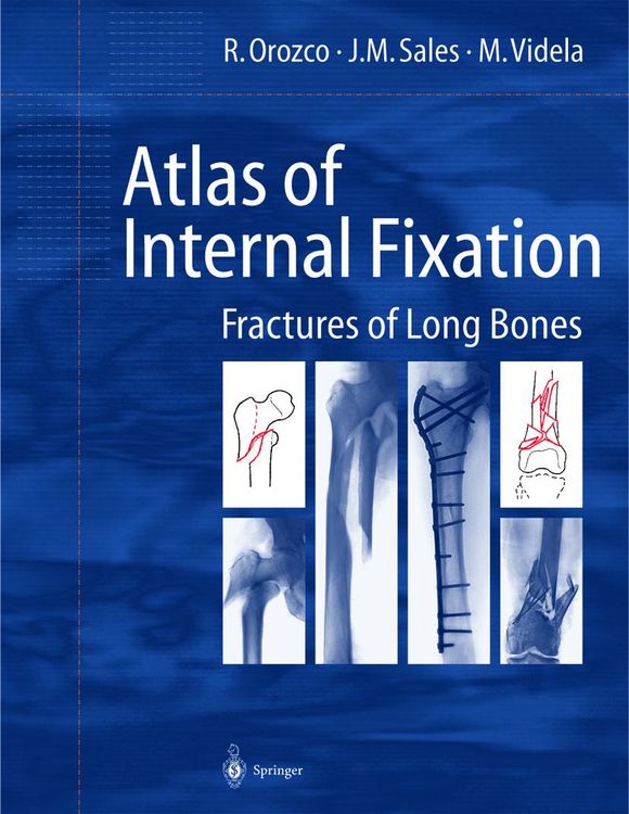 Produktbild: Atlas of Internal Fixation