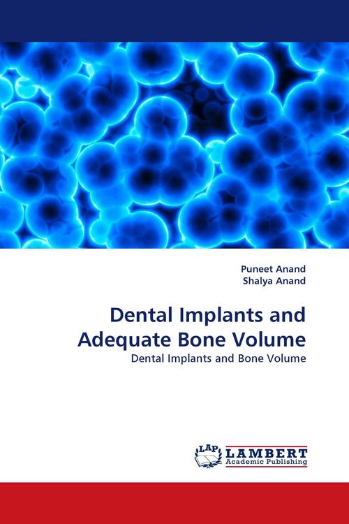 Produktbild: Dental Implants and Adequate Bone Volume