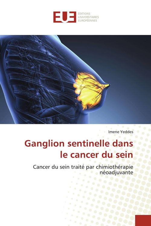 Produktbild: Ganglion sentinelle dans le cancer du sein
