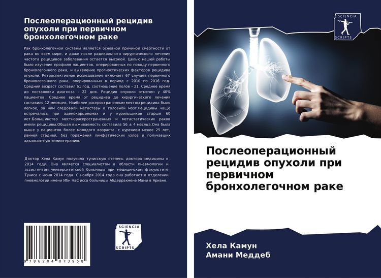 Produktbild: Posleoperacionnyj recidiw opuholi pri perwichnom bronholegochnom rake