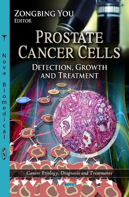 Produktbild: Prostate Cancer Cells