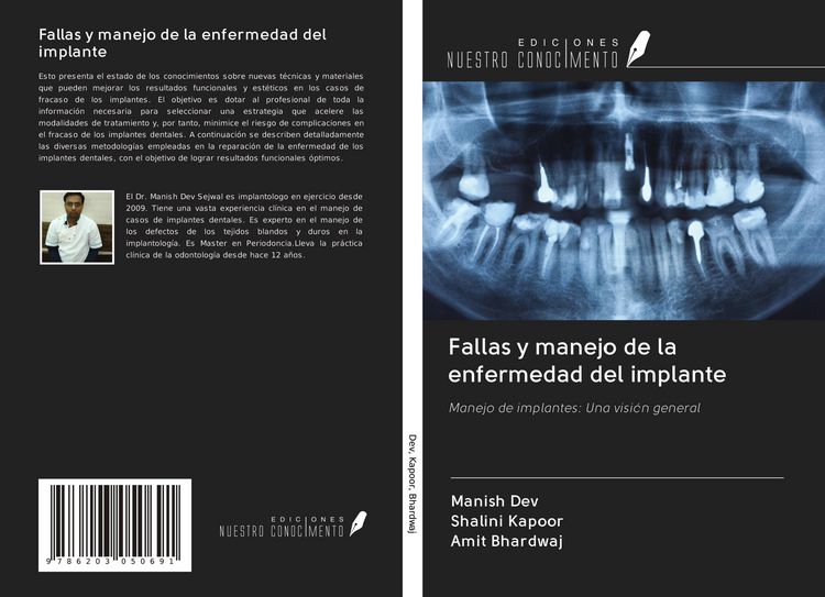 Produktbild: Fallas y manejo de la enfermedad del implante