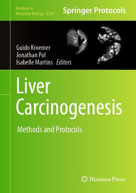 Produktbild: Liver Carcinogenesis