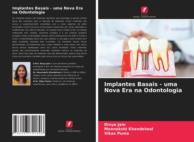 Produktbild: Implantes Basais - uma Nova Era na Odontologia