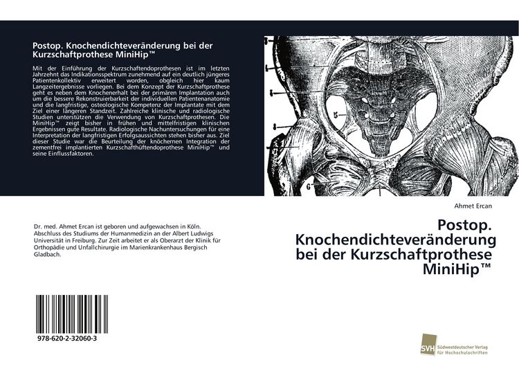 Produktbild: Postop. Knochendichtever&auml;nderung bei der Kurzschaftprothese MiniHip(TM)