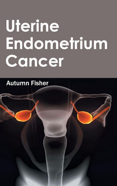 Produktbild: Uterine Endometrium Cancer