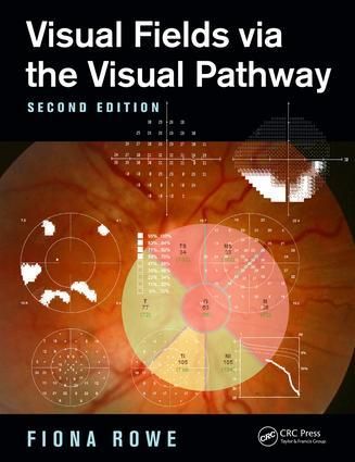 Produktbild: Visual Fields Via the Visual Pathway