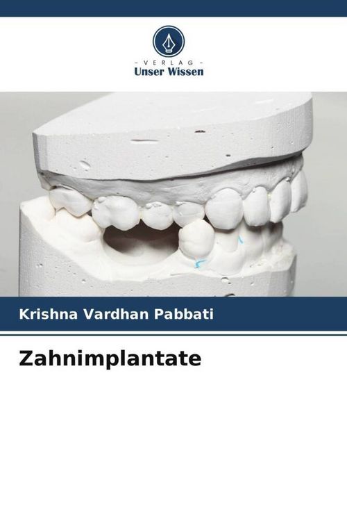 Produktbild: Zahnimplantate