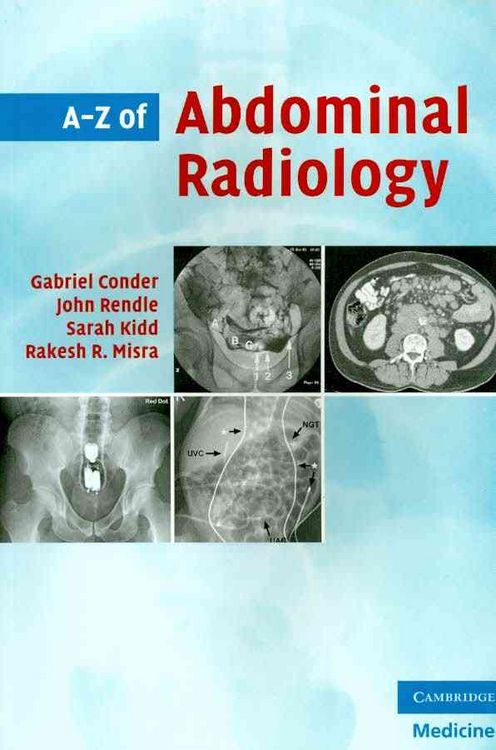 Produktbild: Conder, G: A-Z of Abdominal Radiology